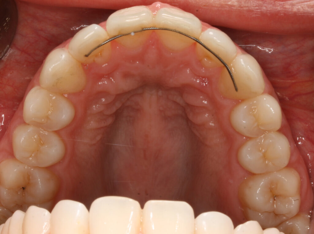 DropFile70875-1 - North Sydney Orthodontics