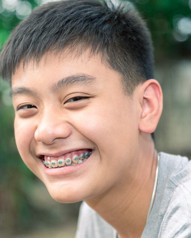 shutterstock_479394613 asian male braces - Copy - North Sydney Orthodontics
